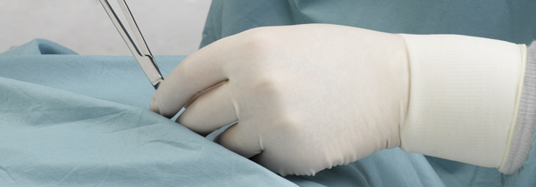 Sterile and Surgical Gloves